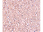 LRRTM2 Antibody in Immunohistochemistry (Paraffin) (IHC (P))