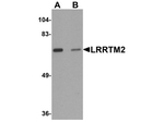 LRRTM2 Antibody in Western Blot (WB)