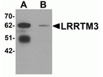 LRRTM3 Antibody in Western Blot (WB)