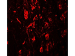 LRRTM4 Polyclonal Antibody
