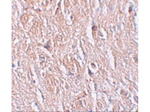 LRRTM4 Antibody in Immunohistochemistry (Paraffin) (IHC (P))