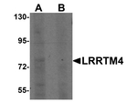 LRRTM4 Antibody in Western Blot (WB)