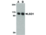 LSD1 Polyclonal Antibody
