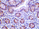 LSD1 Antibody in Immunohistochemistry (Paraffin) (IHC (P))