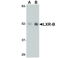 LXR-B Polyclonal Antibody