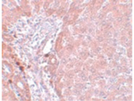 LYRM3 Antibody in Immunohistochemistry (Paraffin) (IHC (P))