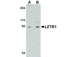 LZTR1 Antibody in Western Blot (WB)