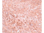 LZTR2 Antibody in Immunohistochemistry (Paraffin) (IHC (P))