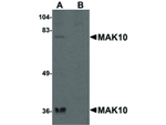 MAK10 Antibody in Western Blot (WB)