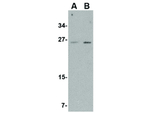 MANF Antibody in Western Blot (WB)