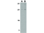 MANF Antibody in Western Blot (WB)