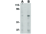 MAPKAP1 Antibody in Western Blot (WB)