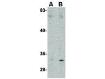 MARCH8 Antibody in Western Blot (WB)