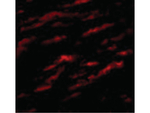 MATN1 Polyclonal Antibody