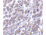 MATN1 Antibody in Immunohistochemistry (Paraffin) (IHC (P))