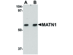 MATN1 Antibody in Western Blot (WB)