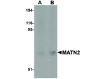 MATN2 Polyclonal Antibody