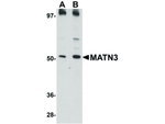 MATN3 Antibody in Western Blot (WB)