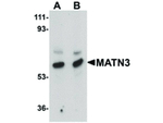 MATN3 Antibody in Western Blot (WB)