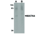 MATN4 Antibody in Western Blot (WB)