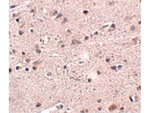 MC4R Antibody in Immunohistochemistry (Paraffin) (IHC (P))