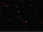 MDA5 Antibody in Immunocytochemistry (ICC/IF)