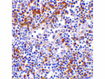 MDA5 Antibody in Immunohistochemistry (Paraffin) (IHC (P))