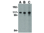 MDA5 Antibody in Western Blot (WB)
