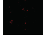 MDA5 Polyclonal Antibody