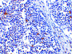 MDA5 Antibody in Immunohistochemistry (Paraffin) (IHC (P))
