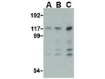 MDA5 Antibody in Western Blot (WB)