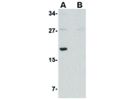 MED28 Polyclonal Antibody