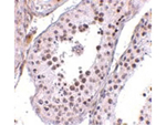 MED4 Polyclonal Antibody