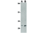 MettL7B Antibody in Western Blot (WB)