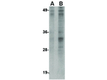 MettL7B Antibody in Western Blot (WB)
