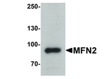MFN2 Antibody in Western Blot (WB)