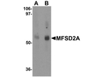 MFSD2A Antibody in Western Blot (WB)