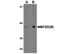 MFSD2B Polyclonal Antibody