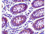 MICA Antibody in Immunohistochemistry (Paraffin) (IHC (P))