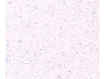 MOX1 Antibody in Immunohistochemistry (Paraffin) (IHC (P))