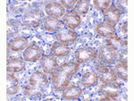 MTCH2 Antibody in Immunohistochemistry (Paraffin) (IHC (P))