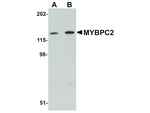 MYBPC2 Antibody in Western Blot (WB)