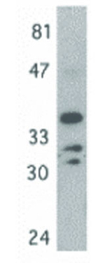 MYD88 Antibody in Western Blot (WB)