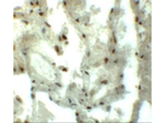 MYOZAP Antibody in Immunohistochemistry (Paraffin) (IHC (P))