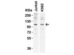 N4BP1 Antibody in Western Blot (WB)