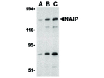 NAIP Antibody in Western Blot (WB)