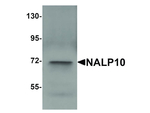 NALP10 Antibody in Western Blot (WB)