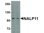 NALP11 Antibody in Western Blot (WB)