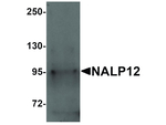 NALP12 Antibody in Western Blot (WB)