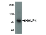 NALP4 Polyclonal Antibody